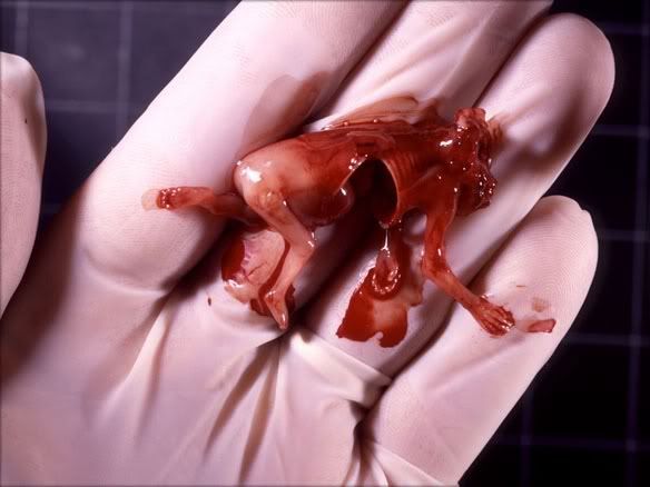 4) 早期 堕胎:10  周大的胎儿 堕胎 五个半月大的胎儿   &
