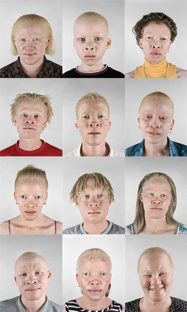 albinos.jpg