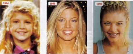 plastica da fergie 1 plastica da fergie 1
