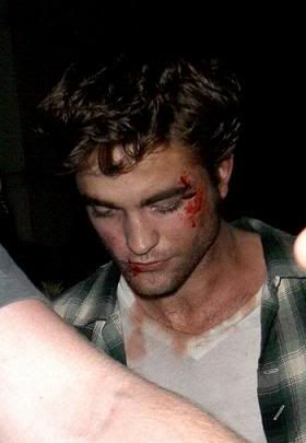 rob pattinson espancado edward ny rob pattinson espancado edward ny