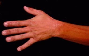 tatuagem-luz-negra tatuagem luz negra